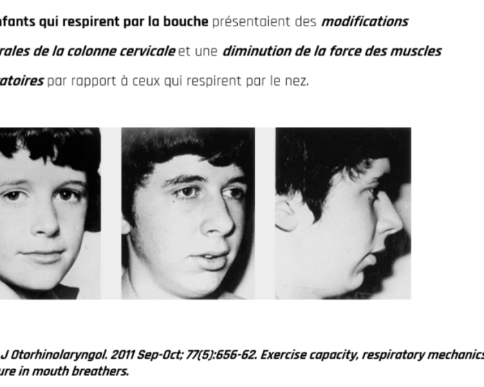 SLIDER 12 BIENFAITS RESPI NASALE